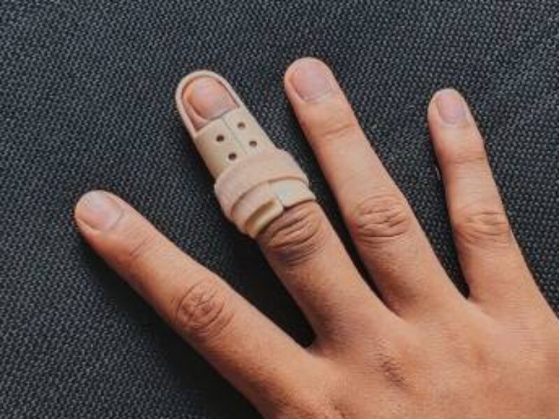 マレットフィンガー